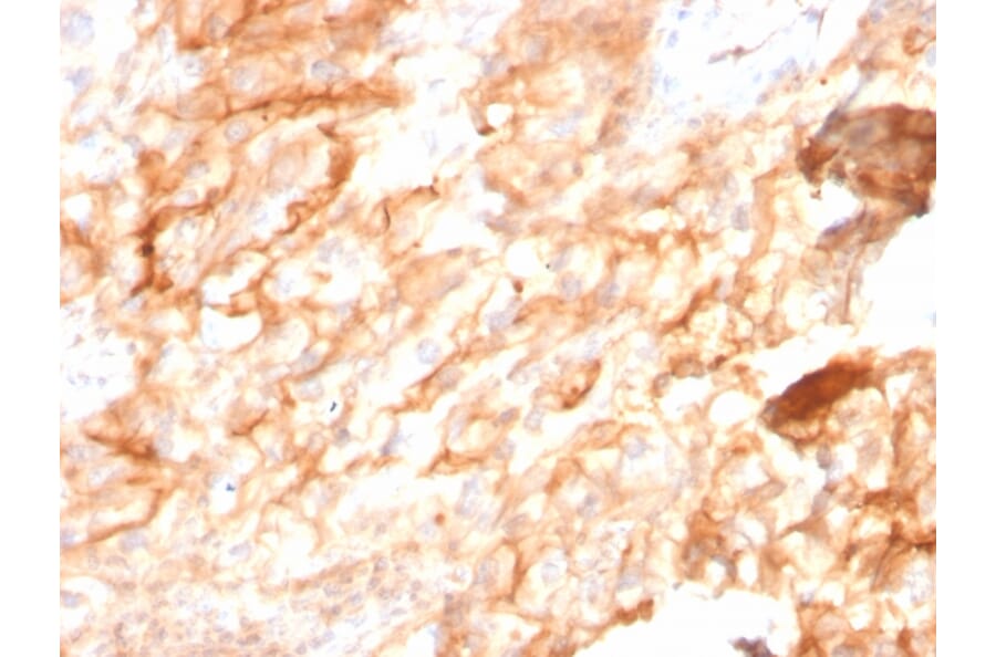 Immunohistochemistry - Anti-CD10 Antibody [MME/2590] (A249359) - Antibodies.com