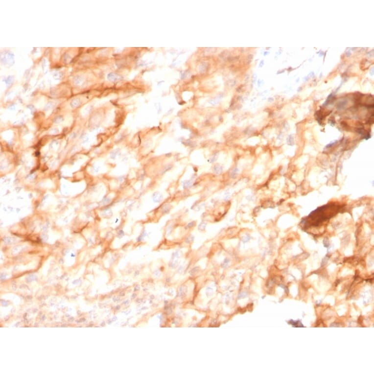 Immunohistochemistry - Anti-CD10 Antibody [MME/2590] (A249359) - Antibodies.com