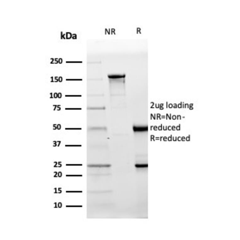 SDS-PAGE - Anti-CD10 Antibody [MME/3739] (A249360) - Antibodies.com