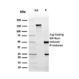 SDS-PAGE - Anti-CD10 Antibody [MME/3739] (A249360) - Antibodies.com