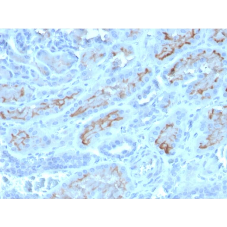 Immunohistochemistry - Anti-CD10 Antibody [MME/4232] (A249362) - Antibodies.com