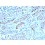 Immunohistochemistry - Anti-CD10 Antibody [MME/4232] (A249362) - Antibodies.com