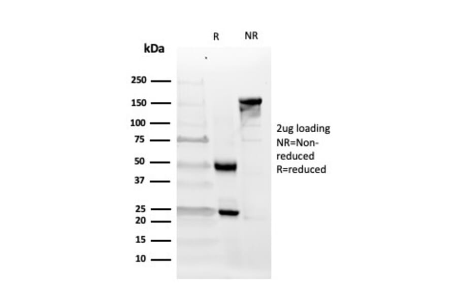 SDS-PAGE - Anti-CD10 Antibody [MME/4232] (A249362) - Antibodies.com
