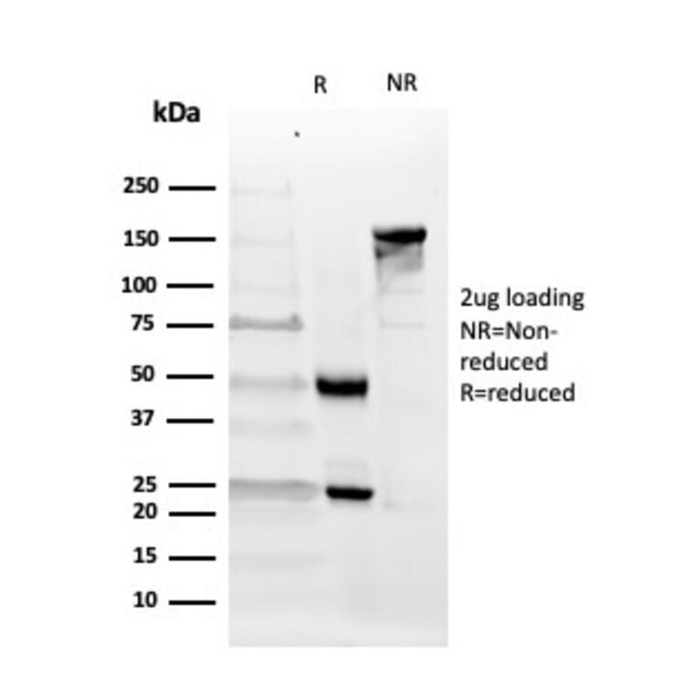 SDS-PAGE - Anti-CD10 Antibody [MME/4232] (A249362) - Antibodies.com
