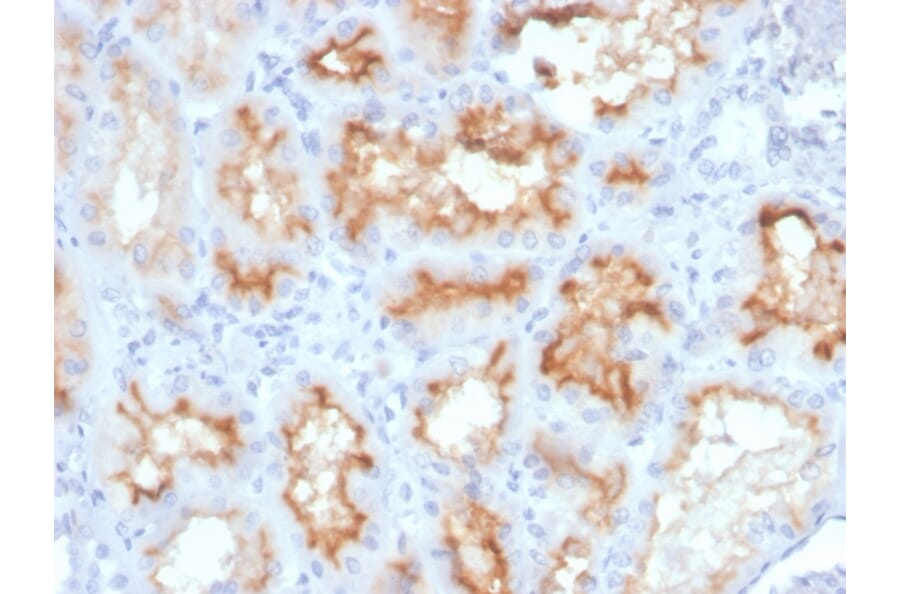 Immunohistochemistry - Anti-CD10 Antibody [MME/4233] (A249363) - Antibodies.com