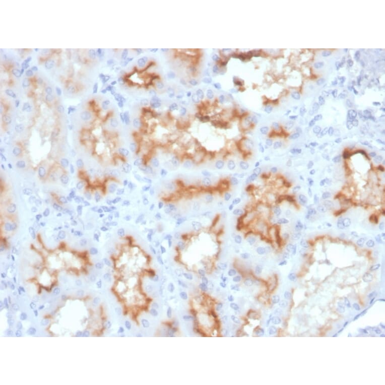 Immunohistochemistry - Anti-CD10 Antibody [MME/4233] (A249363) - Antibodies.com