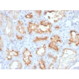 Immunohistochemistry - Anti-CD10 Antibody [MME/4233] (A249363) - Antibodies.com