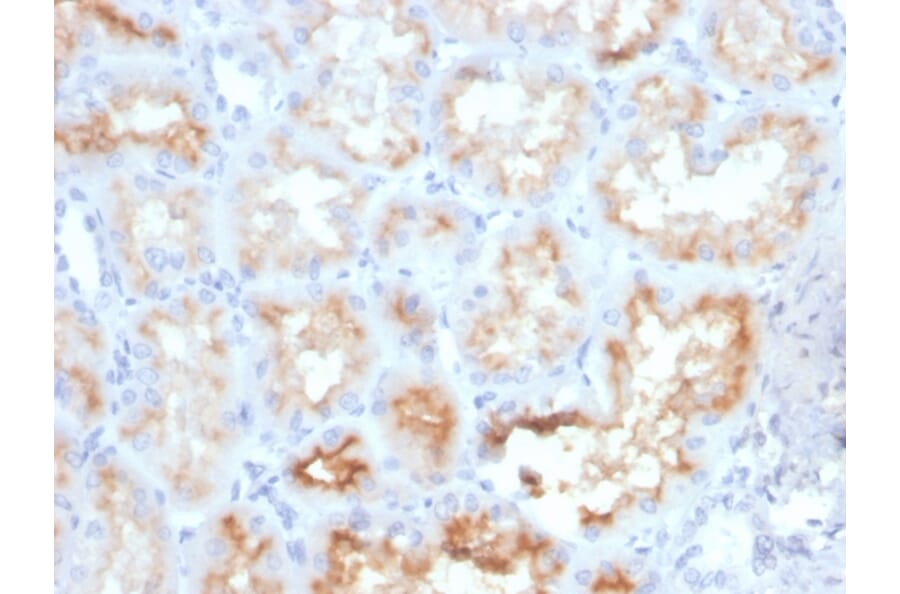 Immunohistochemistry - Anti-CD10 Antibody [MME/4233] (A249363) - Antibodies.com