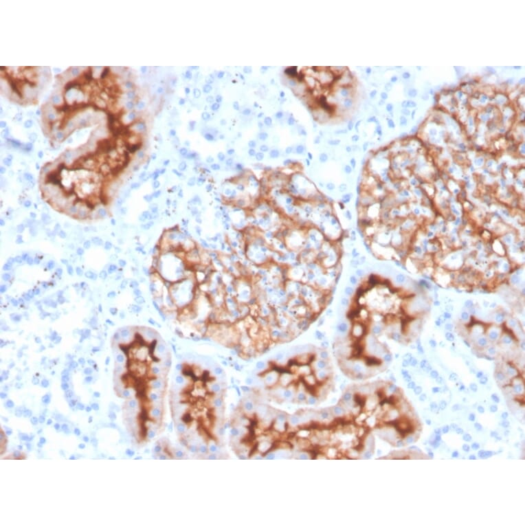 Immunohistochemistry - Anti-CD10 Antibody [MME/4235] (A249364) - Antibodies.com