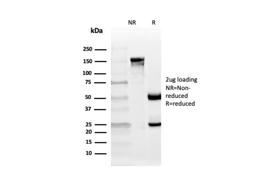 SDS-PAGE - Anti-CD10 Antibody [MME/4235] (A249364) - Antibodies.com