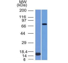 Western Blot - Anti-MMP2 Antibody [MMP2/1501] (A249366) - Antibodies.com