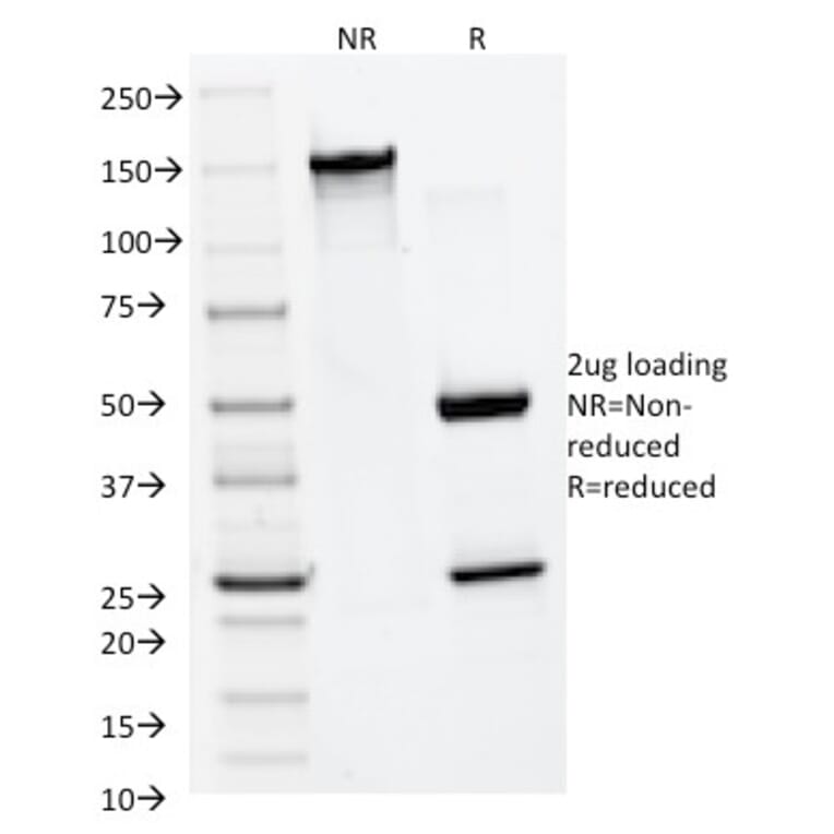 SDS-PAGE - Anti-MMP2 Antibody [MMP2/1501] (A249366) - Antibodies.com