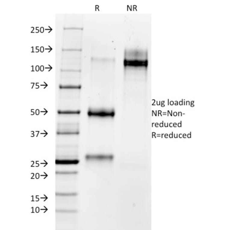 SDS-PAGE - Anti-MMP3 Antibody [1B4] (A249366) - Antibodies.com