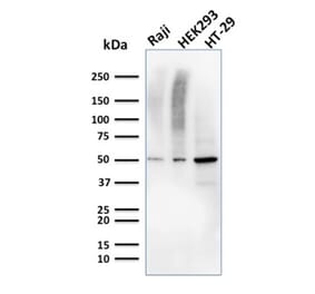 Western Blot - Anti-MMP3 Antibody [MMP3/2655] (A249370) - Antibodies.com