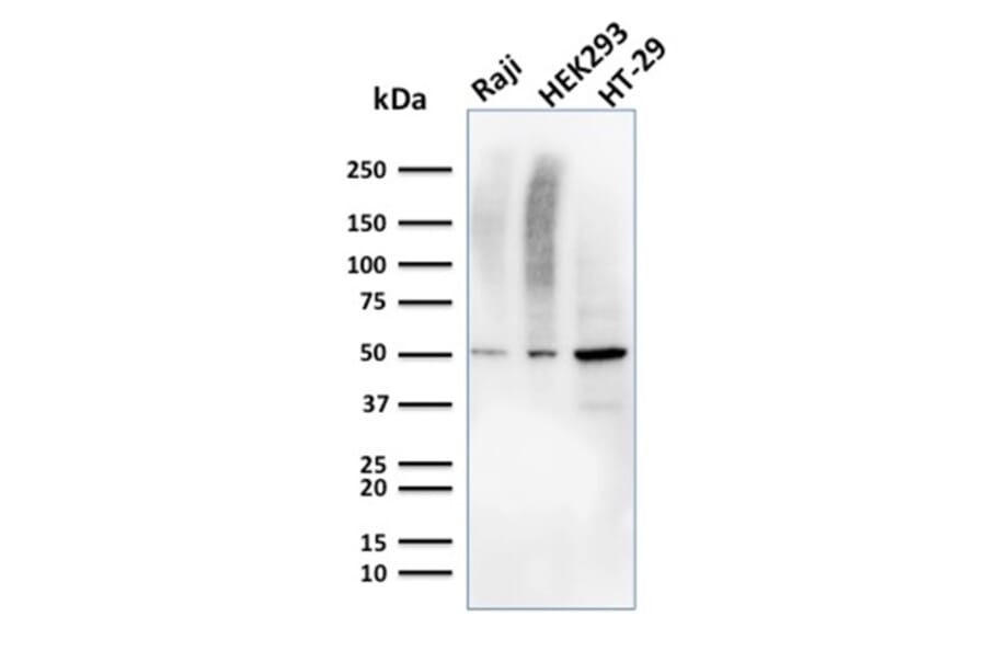 Western Blot - Anti-MMP3 Antibody [MMP3/2655] (A249370) - Antibodies.com