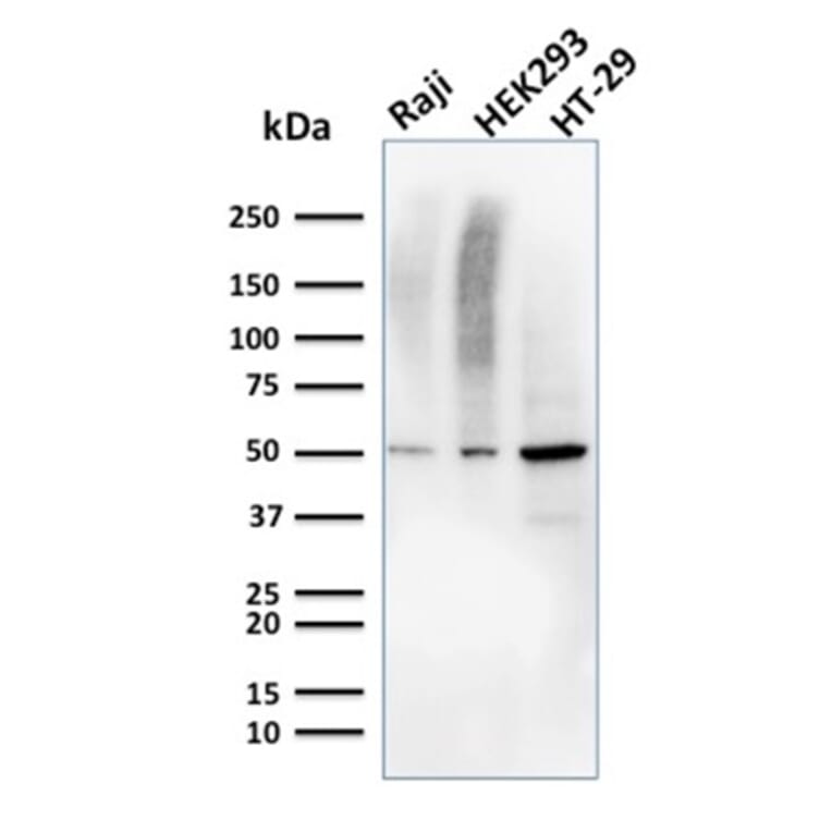 Western Blot - Anti-MMP3 Antibody [MMP3/2655] (A249370) - Antibodies.com