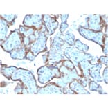 Immunohistochemistry - Anti-MMP3 Antibody [MMP3/2806] (A249371) - Antibodies.com