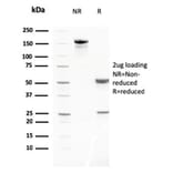 SDS-PAGE - Anti-MMP3 Antibody [MMP3/2806] (A249371) - Antibodies.com