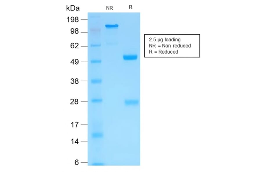 SDS-PAGE - Anti-MMP3 Antibody [MMP3/1994R] (A249371) - Antibodies.com