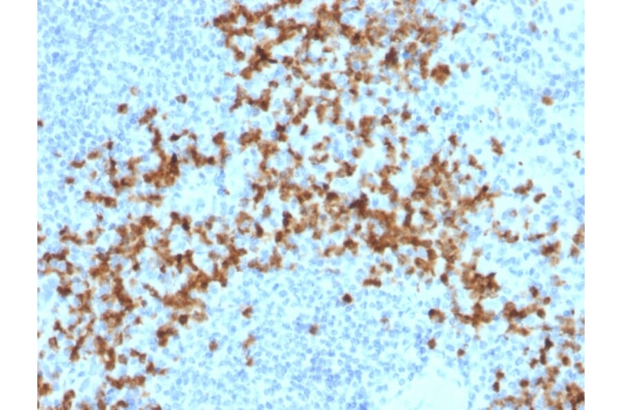 Immunohistochemistry - Anti-MMP9 Antibody [2C3] (A249372) - Antibodies.com