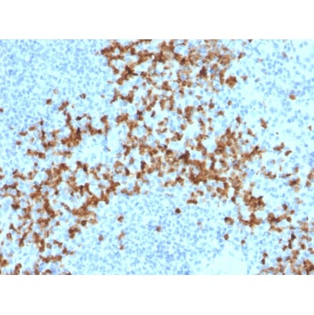 Immunohistochemistry - Anti-MMP9 Antibody [2C3] (A249372) - Antibodies.com