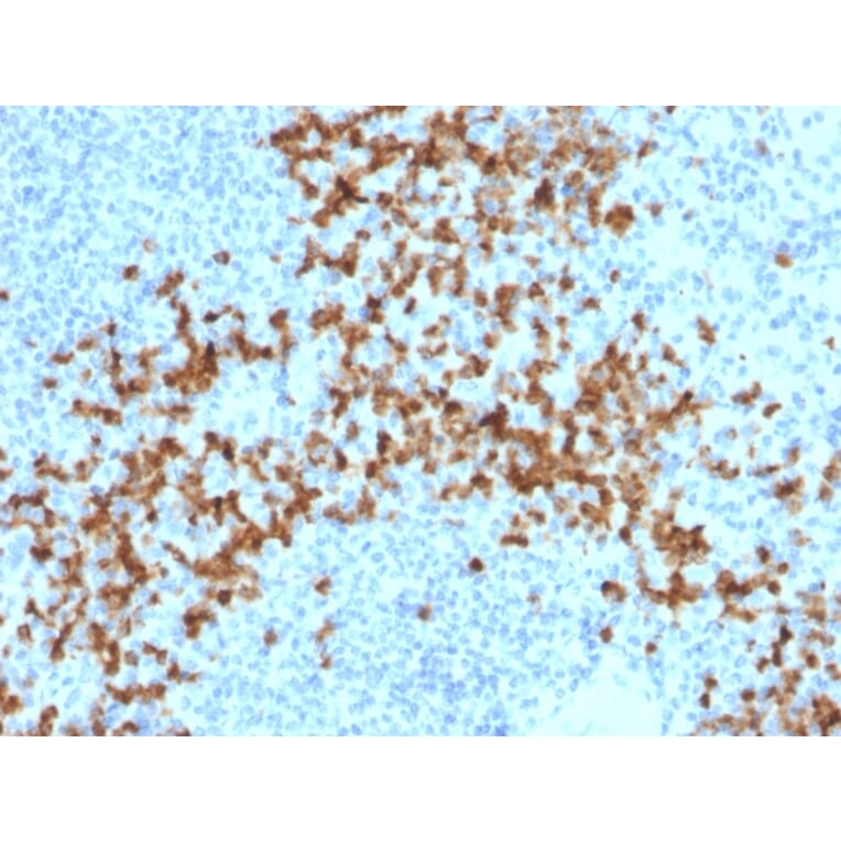 Immunohistochemistry - Anti-MMP9 Antibody [2C3] (A249372) - Antibodies.com