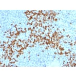 Immunohistochemistry - Anti-MMP9 Antibody [2C3] (A249372) - Antibodies.com