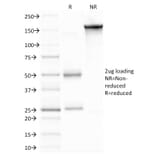 SDS-PAGE - Anti-MMP9 Antibody [2C3] (A249373) - Antibodies.com