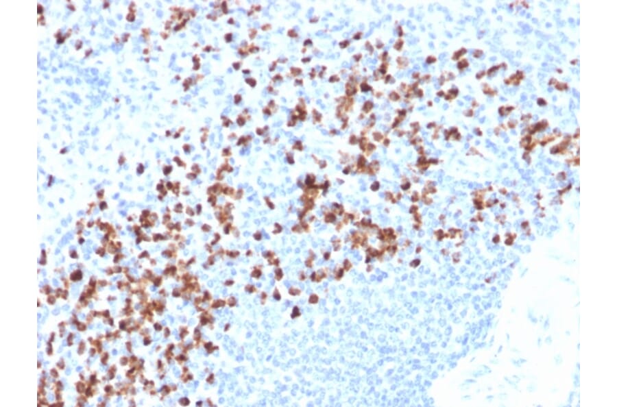 Immunohistochemistry - Anti-MMP9 Antibody [rMMP9/1769] (A249373) - Antibodies.com