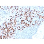 Immunohistochemistry - Anti-MMP9 Antibody [rMMP9/1769] (A249373) - Antibodies.com