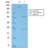 SDS-PAGE - Anti-MMP9 Antibody [rMMP9/1769] (A249374) - Antibodies.com