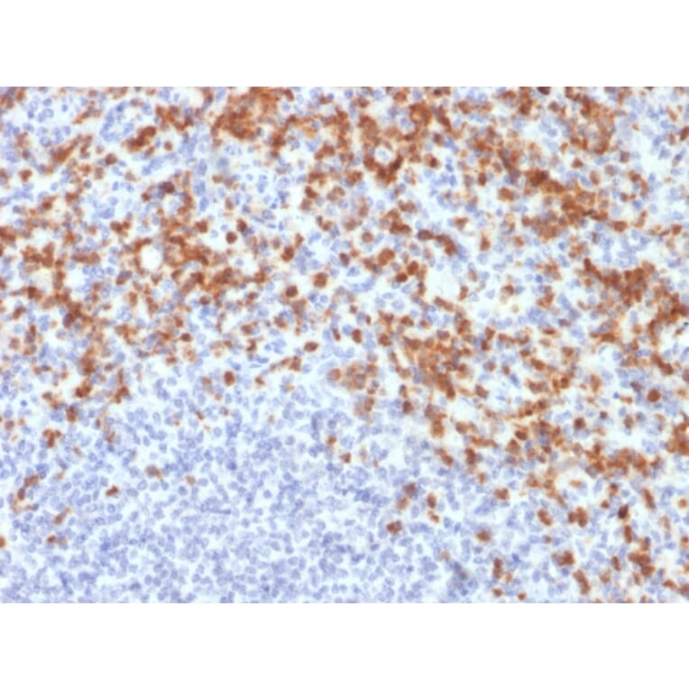 Immunohistochemistry - Anti-MMP9 Antibody [MMP9/2477] (A249374) - Antibodies.com