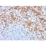 Immunohistochemistry - Anti-MMP9 Antibody [MMP9/2477] (A249374) - Antibodies.com