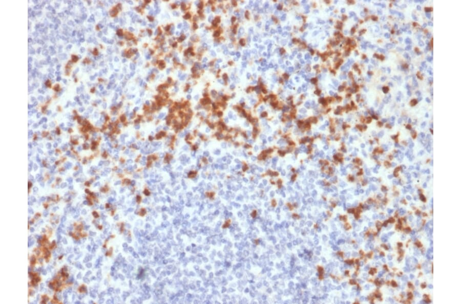 Immunohistochemistry - Anti-MMP9 Antibody [SPM425] (A249375) - Antibodies.com