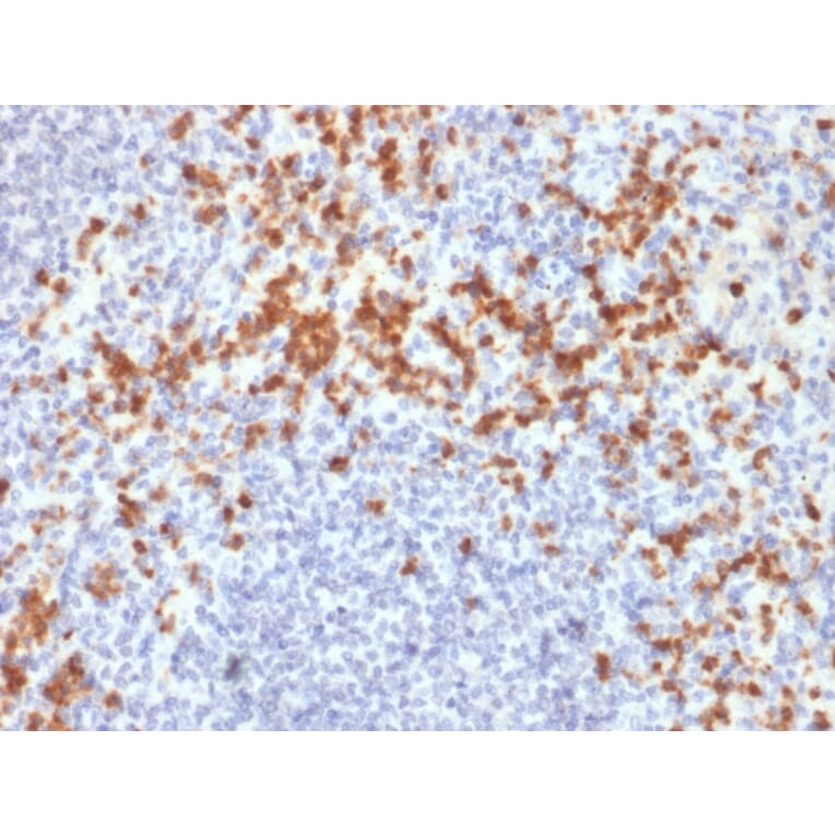 Immunohistochemistry - Anti-MMP9 Antibody [SPM425] (A249375) - Antibodies.com