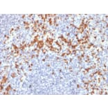 Immunohistochemistry - Anti-MMP9 Antibody [SPM425] (A249375) - Antibodies.com