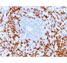 Immunohistochemistry - Anti-MMP9 Antibody [MMP9/2025R] (A249376) - Antibodies.com