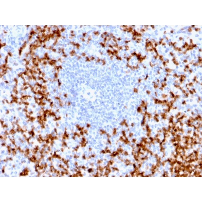 Immunohistochemistry - Anti-MMP9 Antibody [MMP9/2025R] (A249376) - Antibodies.com