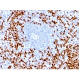 Immunohistochemistry - Anti-MMP9 Antibody [MMP9/2025R] (A249376) - Antibodies.com