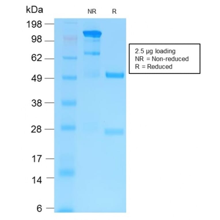 SDS-PAGE - Anti-MMP9 Antibody [MMP9/2025R] (A249377) - Antibodies.com