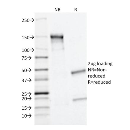 SDS-PAGE - Anti-MRP1 Antibody [MRP1/1343] (A249377) - Antibodies.com