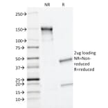 SDS-PAGE - Anti-MRP1 Antibody [MRP1/1343] (A249377) - Antibodies.com