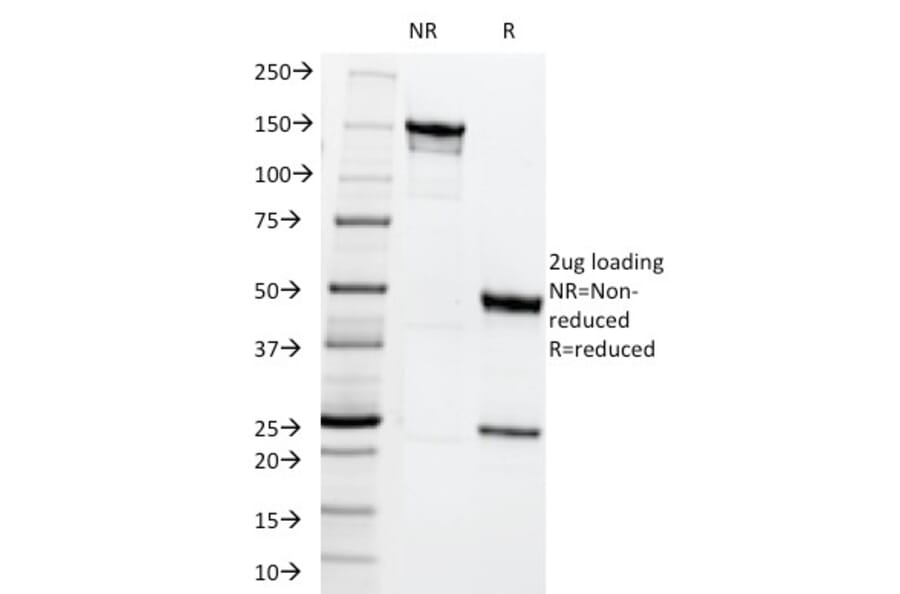 SDS-PAGE - Anti-MRP1 Antibody [MRP1/1344] (A249378) - Antibodies.com