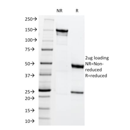 SDS-PAGE - Anti-MRP1 Antibody [MRP1/1344] (A249378) - Antibodies.com