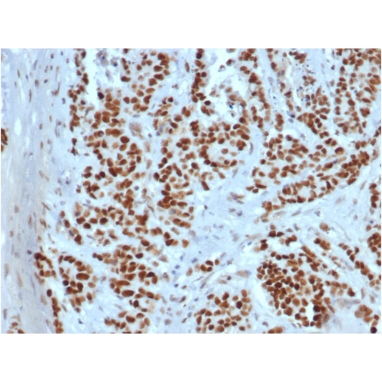 Immunohistochemistry - Anti-MSH2 Antibody [rMSH2/6548] (A249379) - Antibodies.com