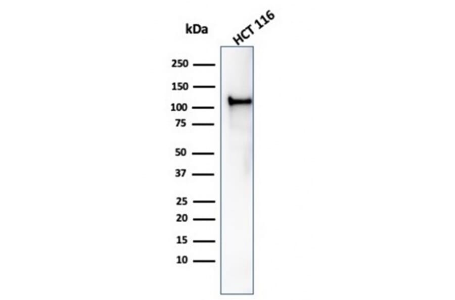 Western Blot - Anti-MSH2 Antibody [rMSH2/6548] (A249380) - Antibodies.com