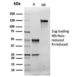 SDS-PAGE - Anti-MSH2 Antibody [rMSH2/6548] (A249380) - Antibodies.com