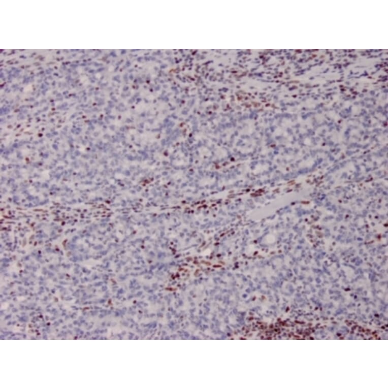 Immunohistochemistry - Anti-MSH2 Antibody [MSH2/2622] (A249381) - Antibodies.com