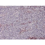 Immunohistochemistry - Anti-MSH2 Antibody [MSH2/2622] (A249381) - Antibodies.com
