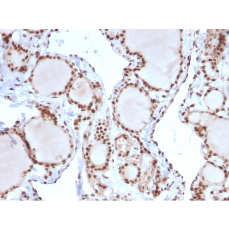 Immunohistochemistry - Anti-MSH2 Antibody [MSH2/2622] (A249381) - Antibodies.com